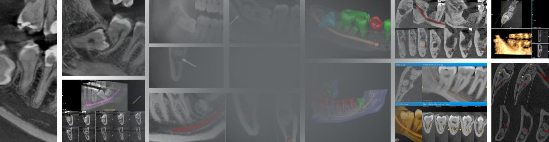 CT Dent CTdent_slide_molar_notext Slider 14  